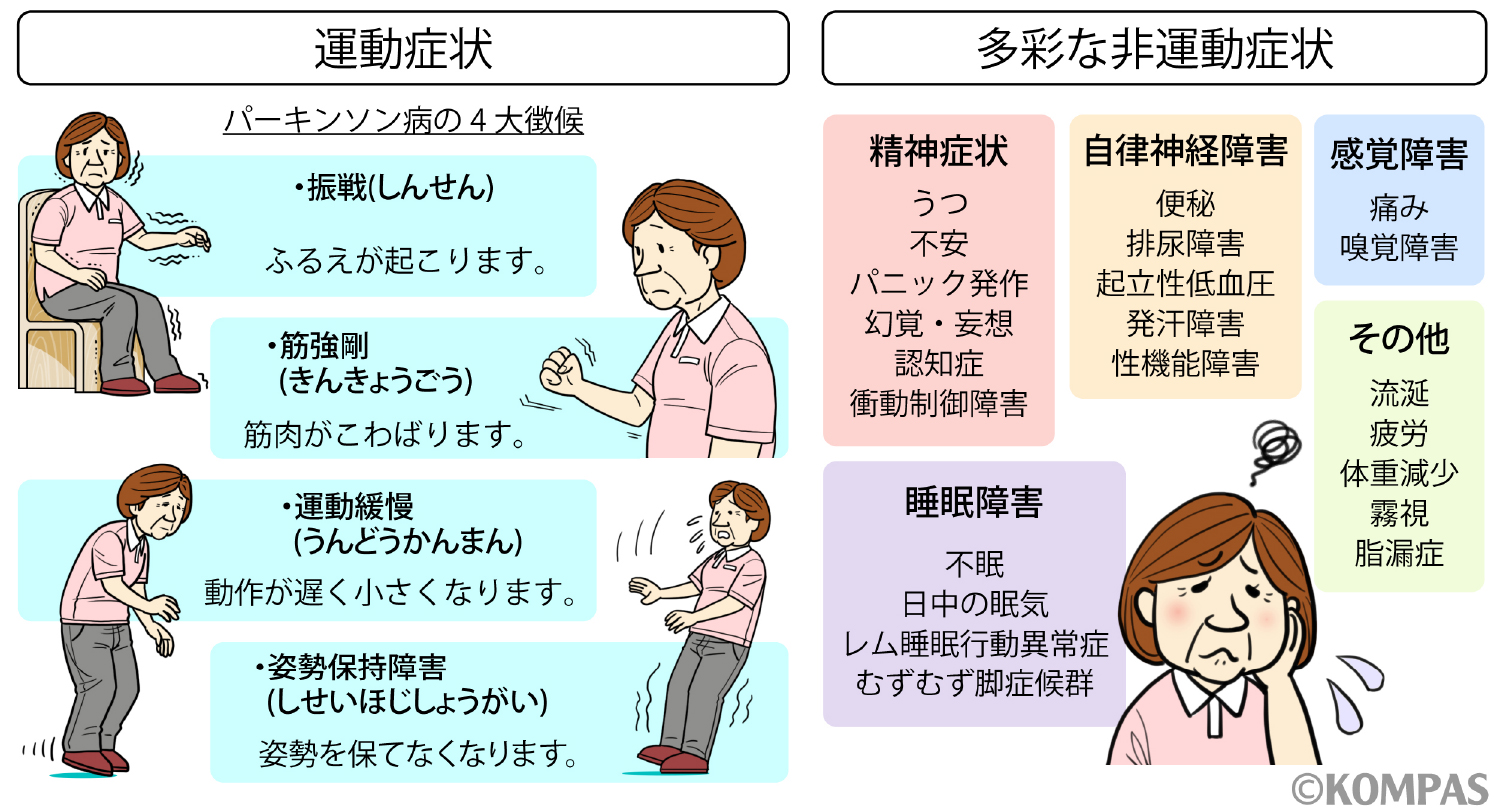 手の震えや便秘は前兆か？パーキンソン病の初期症状と早期発見の鍵