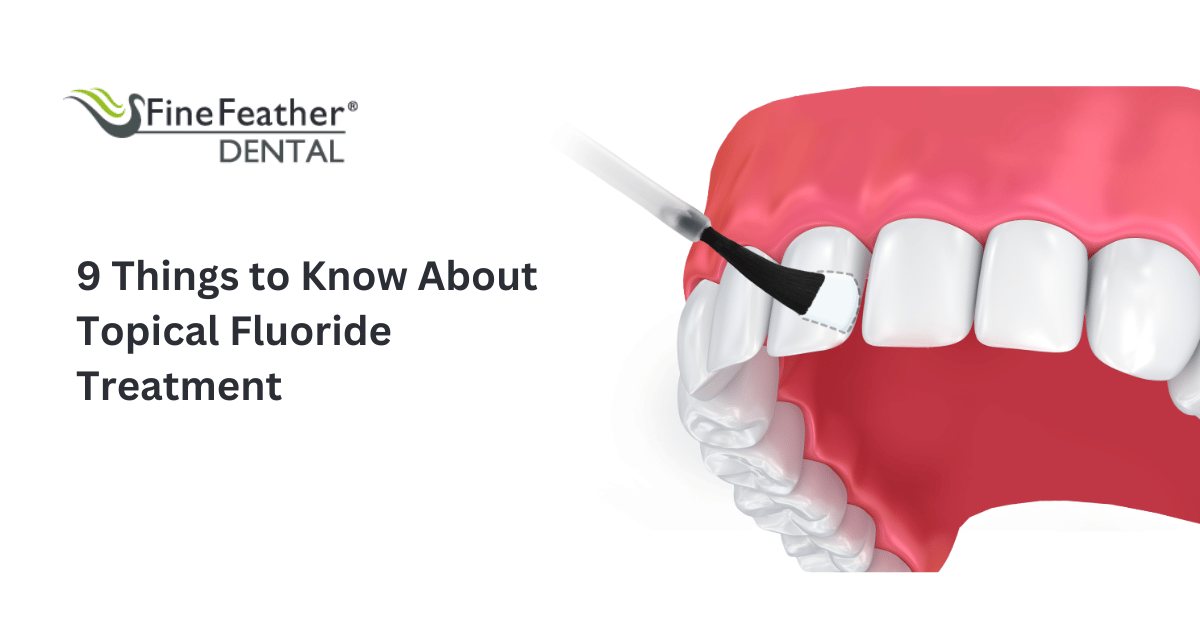 At Home Fluoride Treatment
