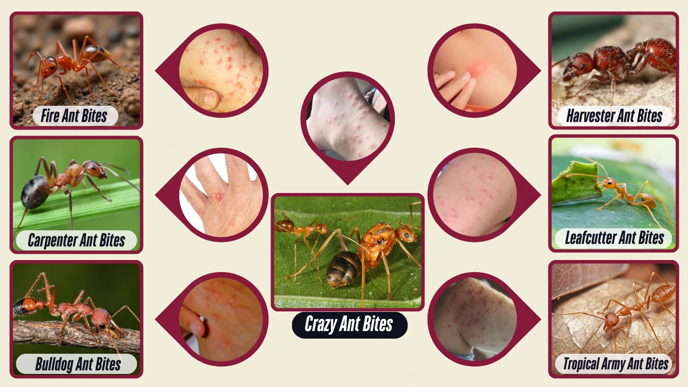 What Type of Ant Bites