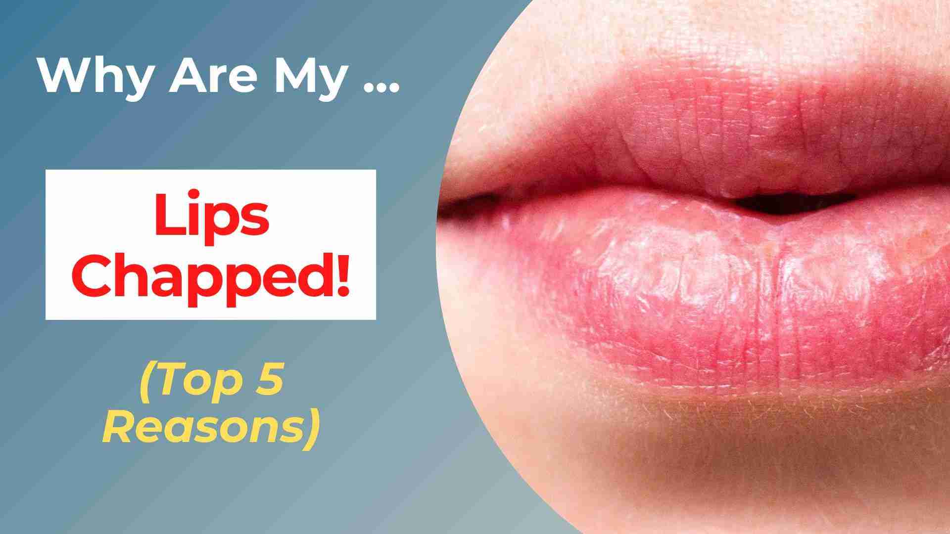 Why Are My Lips Always Chapped
