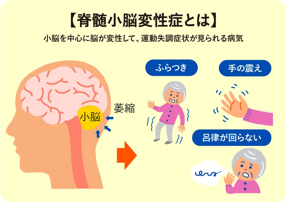 脊髄小脳変性症が治る確率は？2026年最新治療と完治への現在地