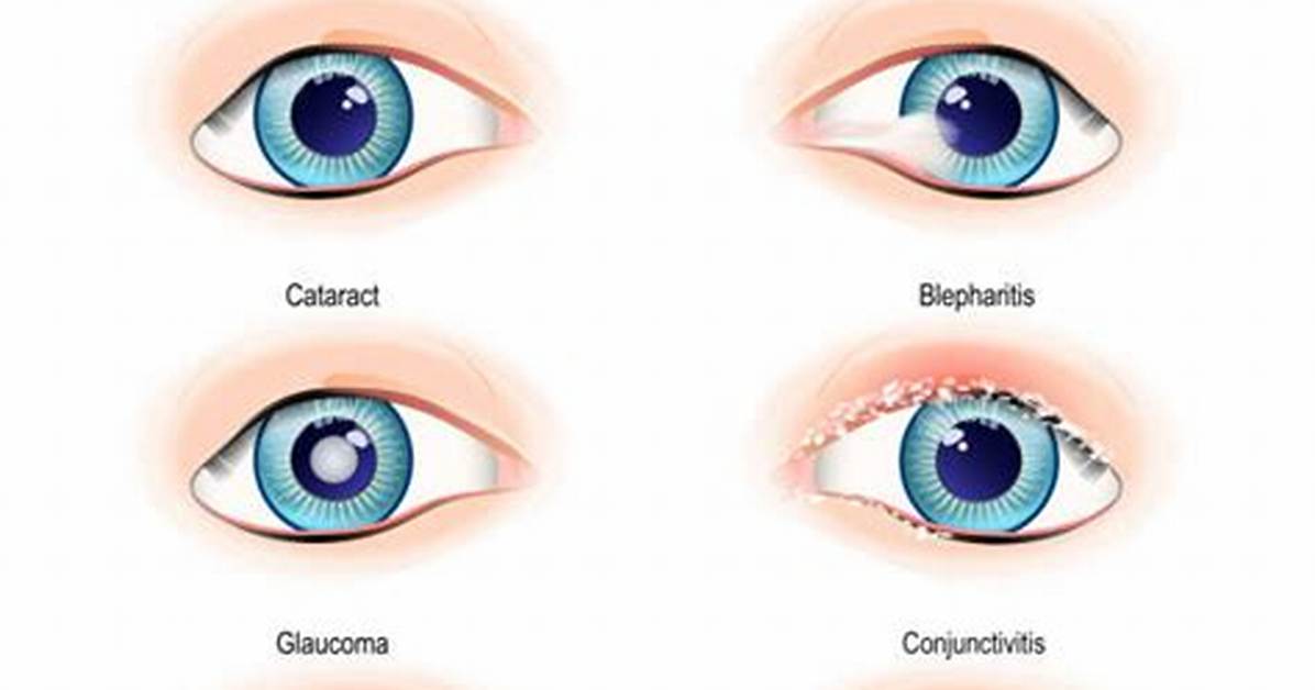 Eye Disease