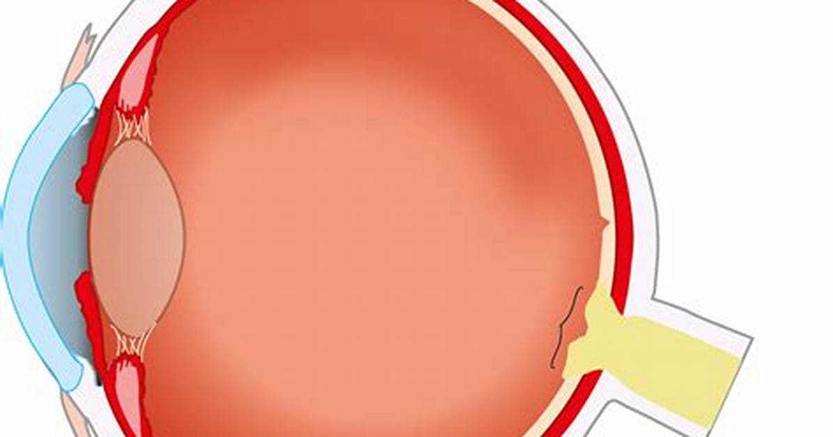 Eye