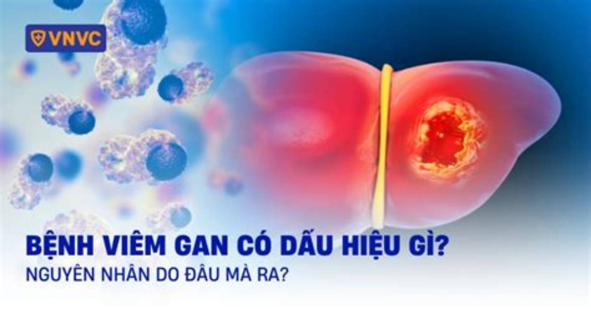 Gan Xingga