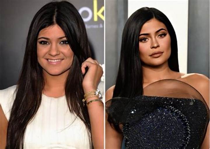 Kylie Jenner Before and After: What Changed, What Didn’t, and Why