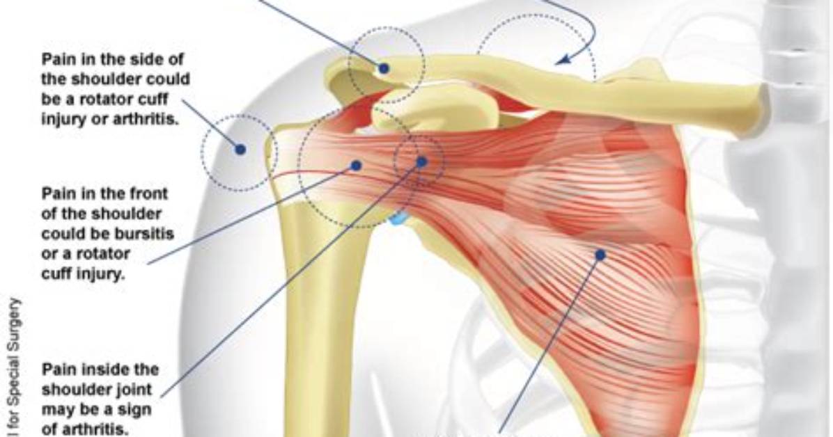 Shoulder Pain