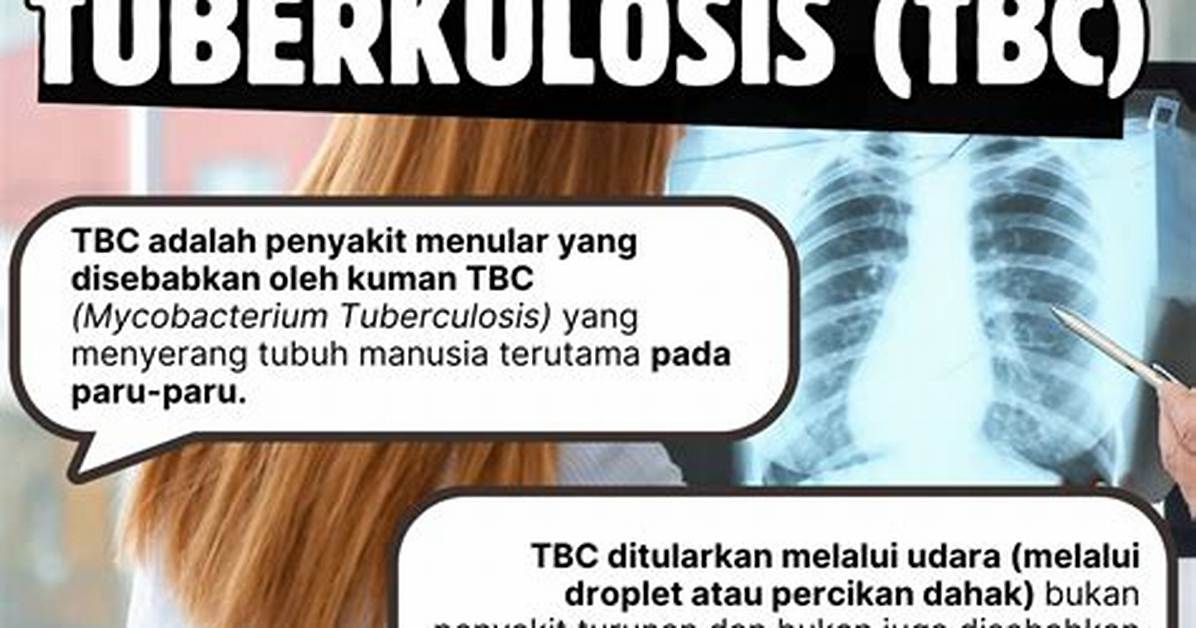 Tbc Tuo