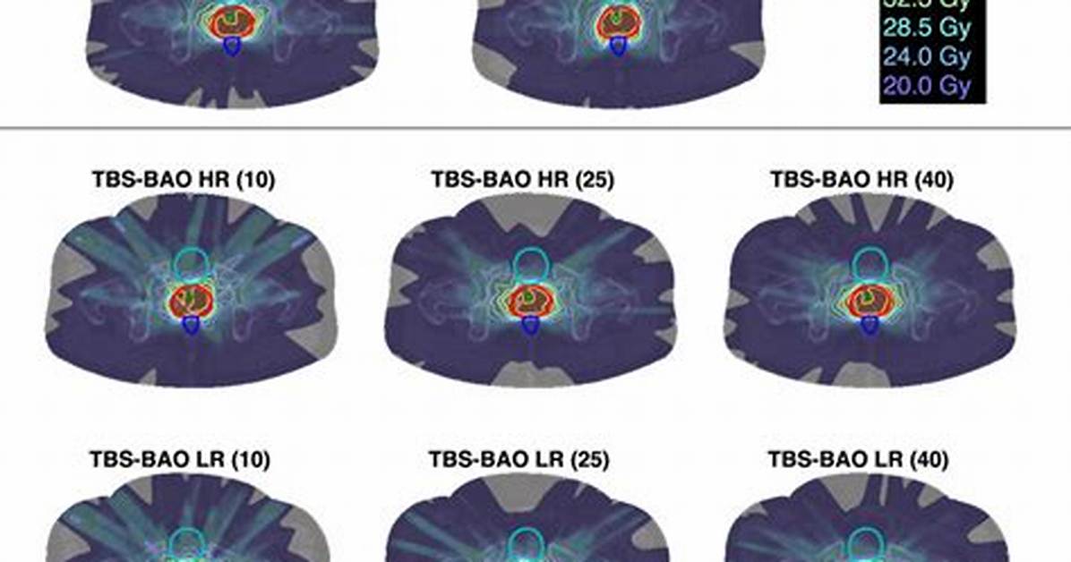 Tbs Bao