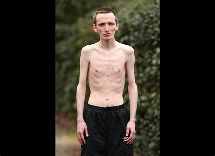 The World’s Skinniest Person: What “Skinniness” Really Means